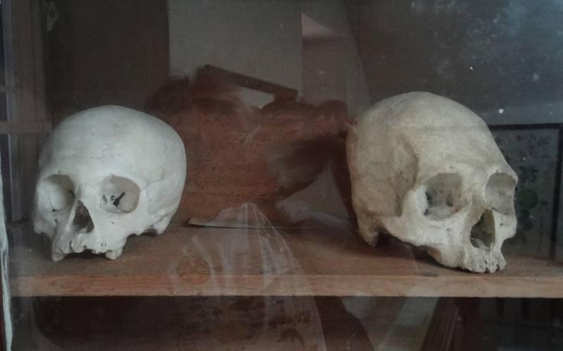 human skulls